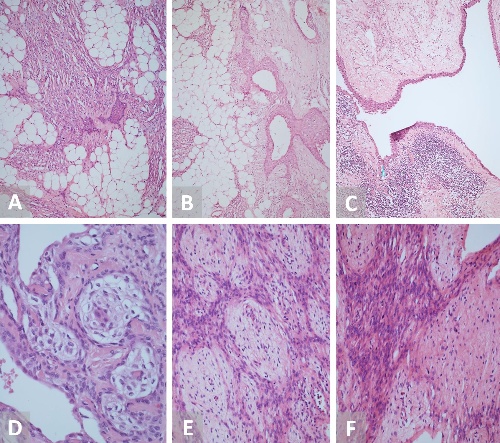 Figure 2.JPG